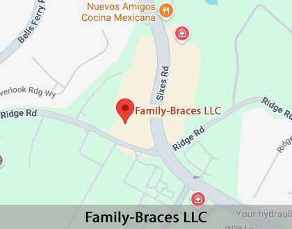 Map image for Adult Orthodontics in Canton, GA